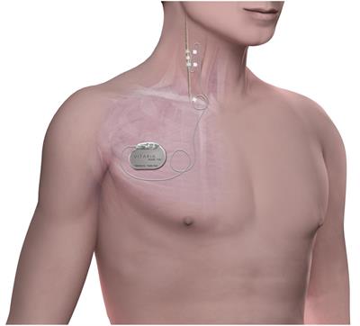 Persistent Autonomic Engagement and Cardiac Control After Four or More Years of Autonomic Regulation Therapy Using Vagus Nerve Stimulation